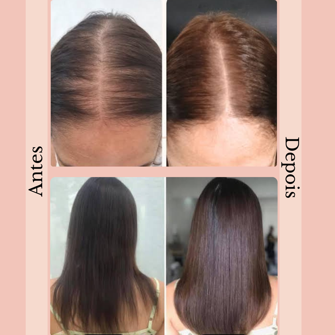 Terapia capilar Serená & brinde potencializador