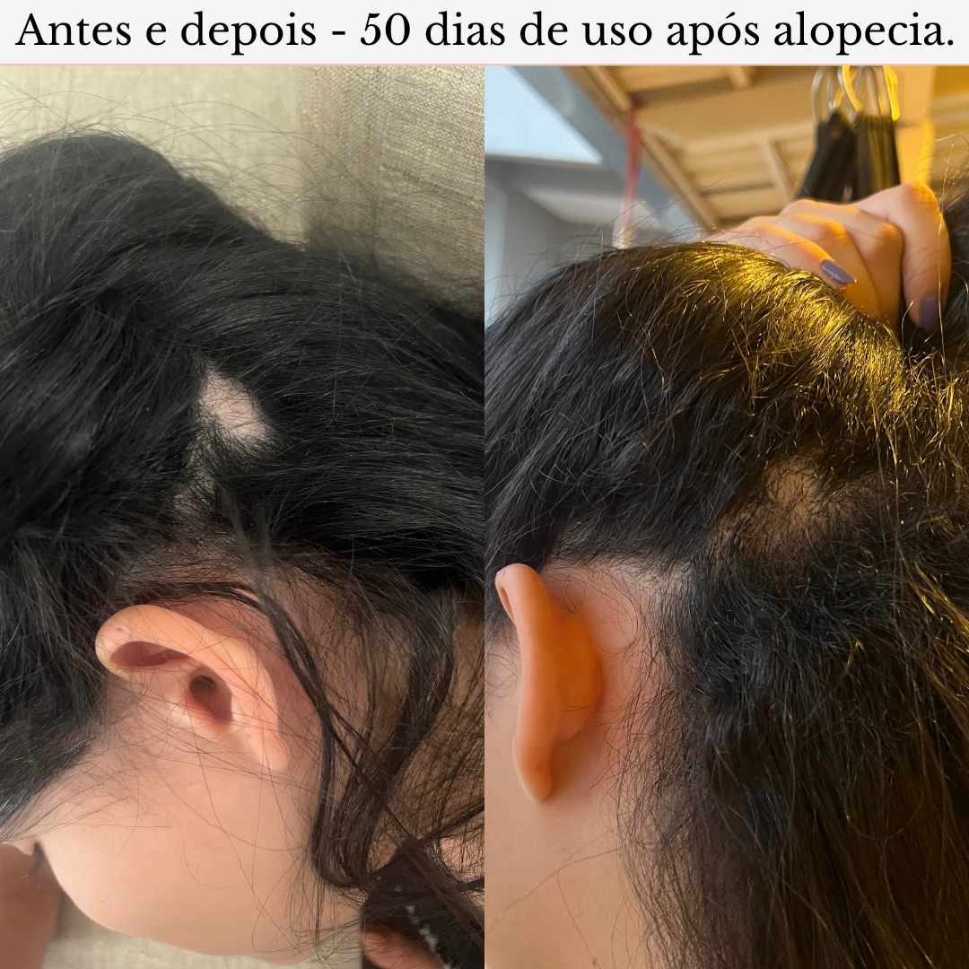 Terapia capilar Serená - Crescimento e Fortalecimento