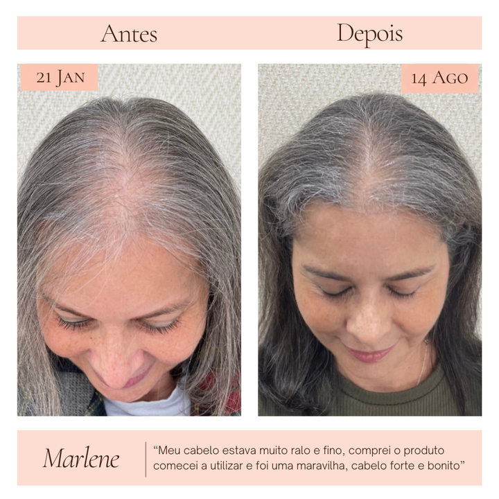 Terapia capilar Serená - Crescimento e Fortalecimento