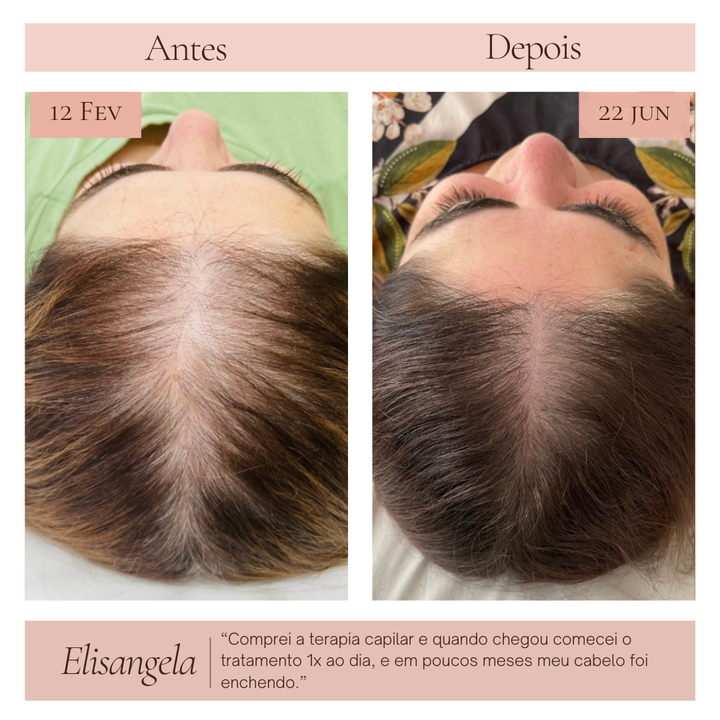 Terapia capilar Serená - Crescimento e Fortalecimento